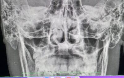 Sofia Aires: Les informo que mi hermano viajo al hospital de Trenque Lauquen y en estos momentos esta siendo sometido una cirugía